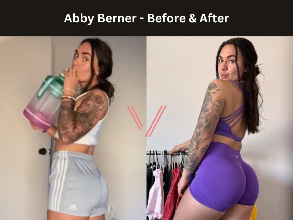 Abby Berner BBL Before and After
