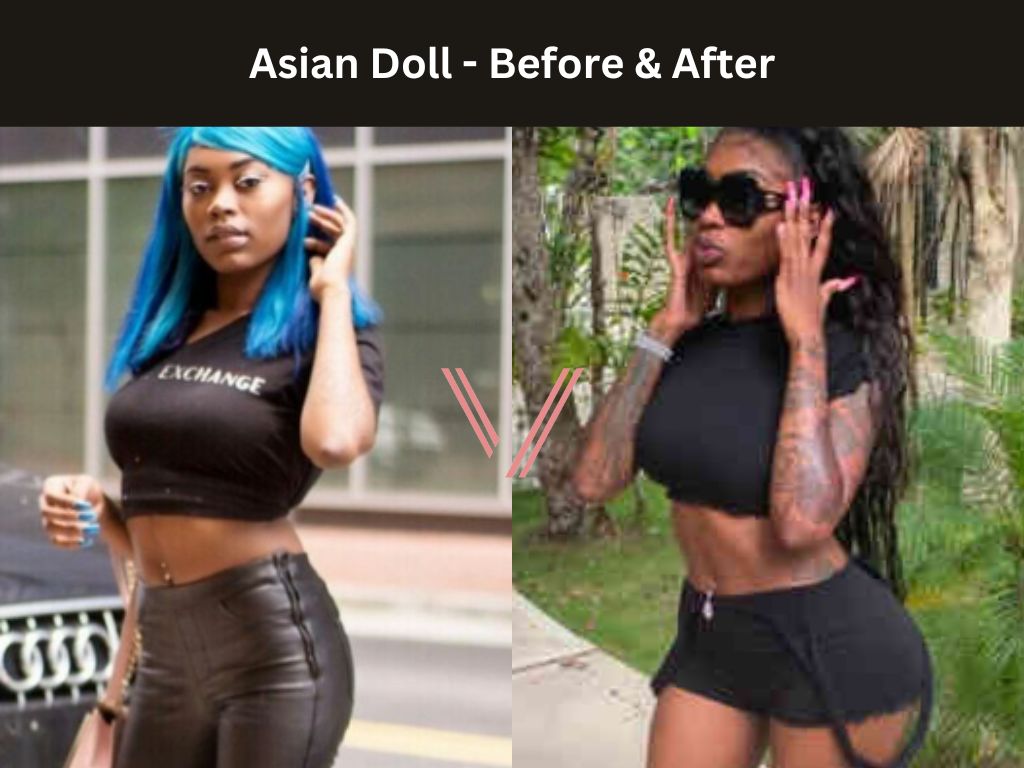 Asian Doll BBL Before and After