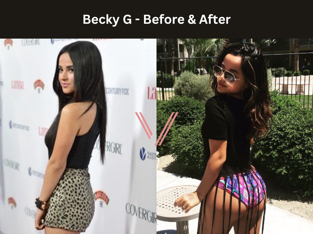 Becky G BBL Before and After