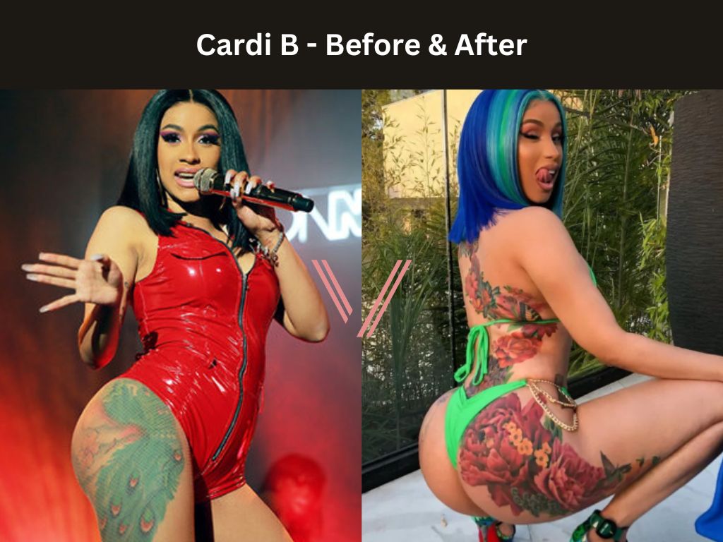 Cardi B BBL Before and After