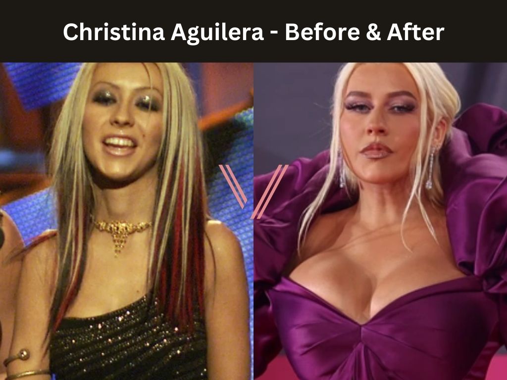 Christina Aguilera - Breast Implant Before and After