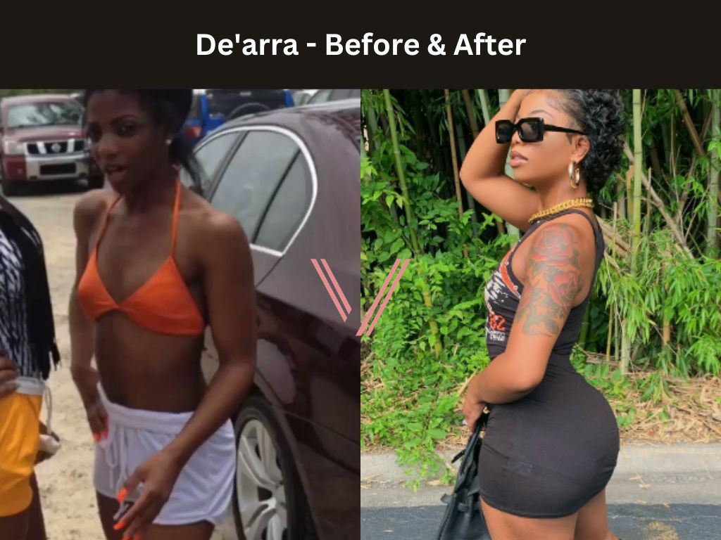De'arra BBL Before and After