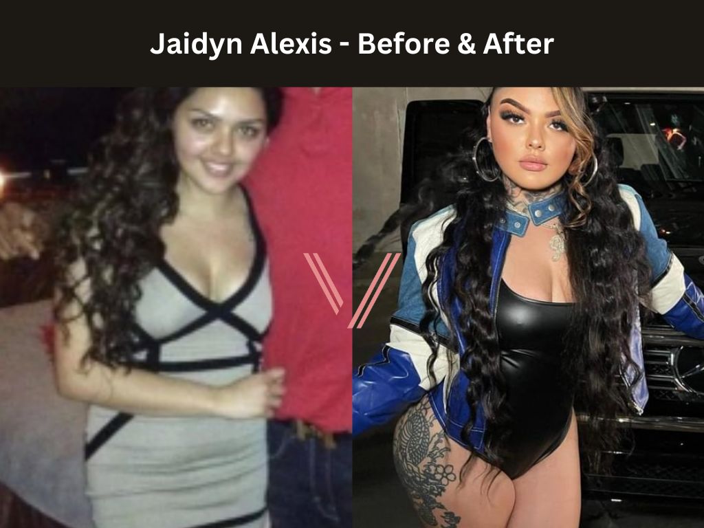 Jaidyn Alexis BBL Before and After