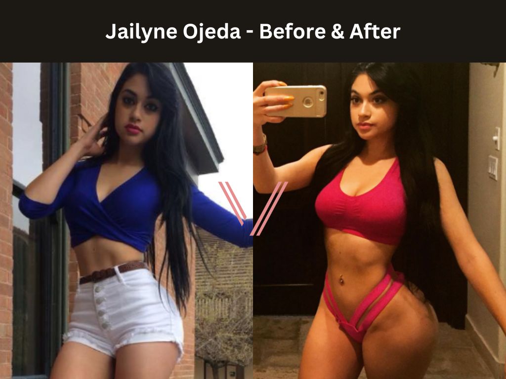Jailyne Ojeda BBL Before and After