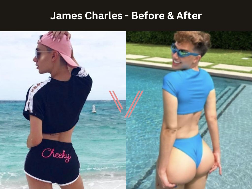 James Charles BBL Before and After