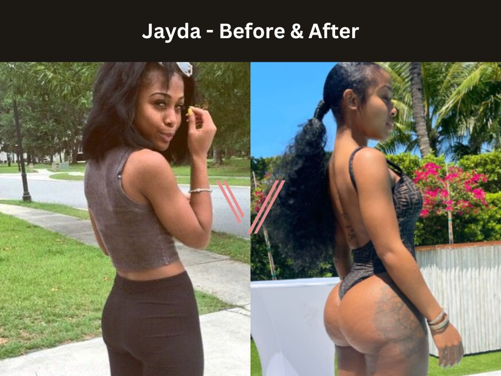 Jayda BBL Before and After