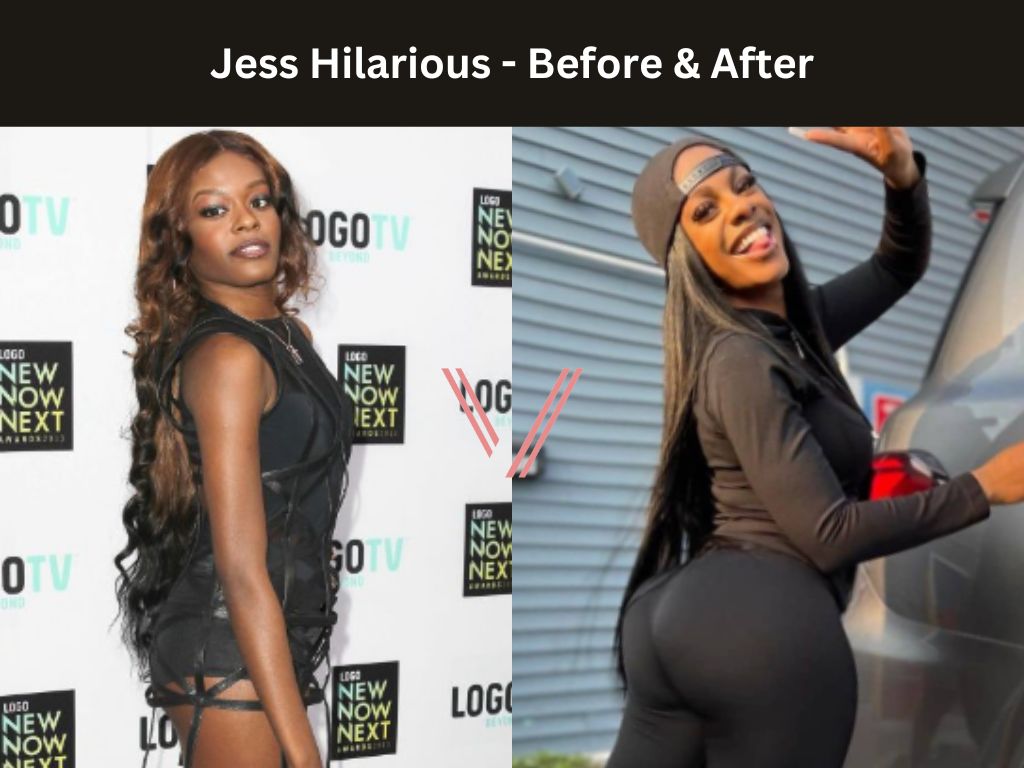 Jess Hilarious  BBL Before and After