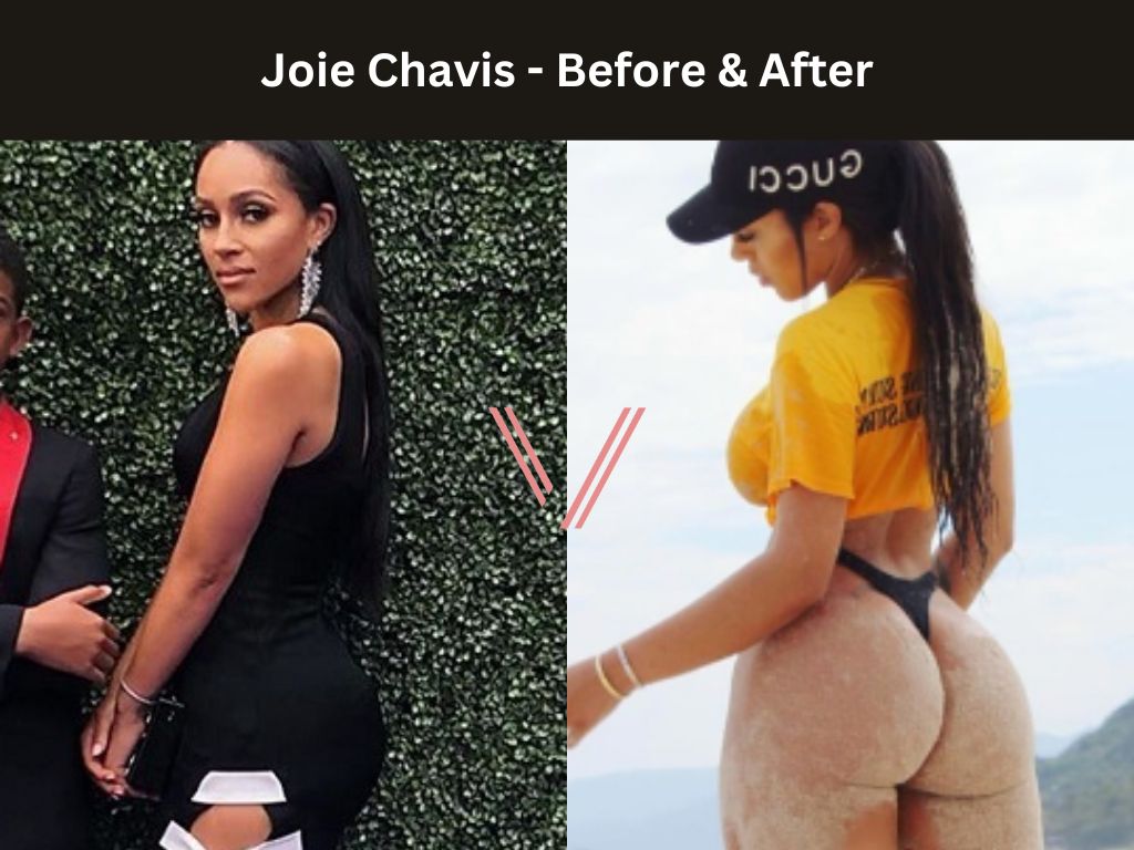 Joie Chavis BBL Before and After