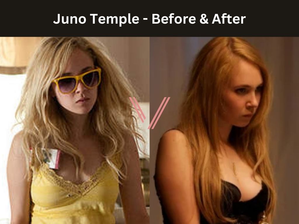 Juno Temple - Breast Implant Before and After