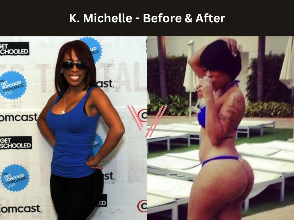 K. Michelle BBL Before and After