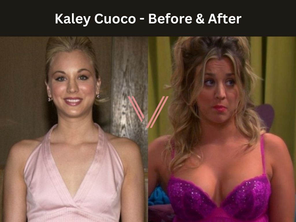 Kaley Cuoco Breast Implant Before and After