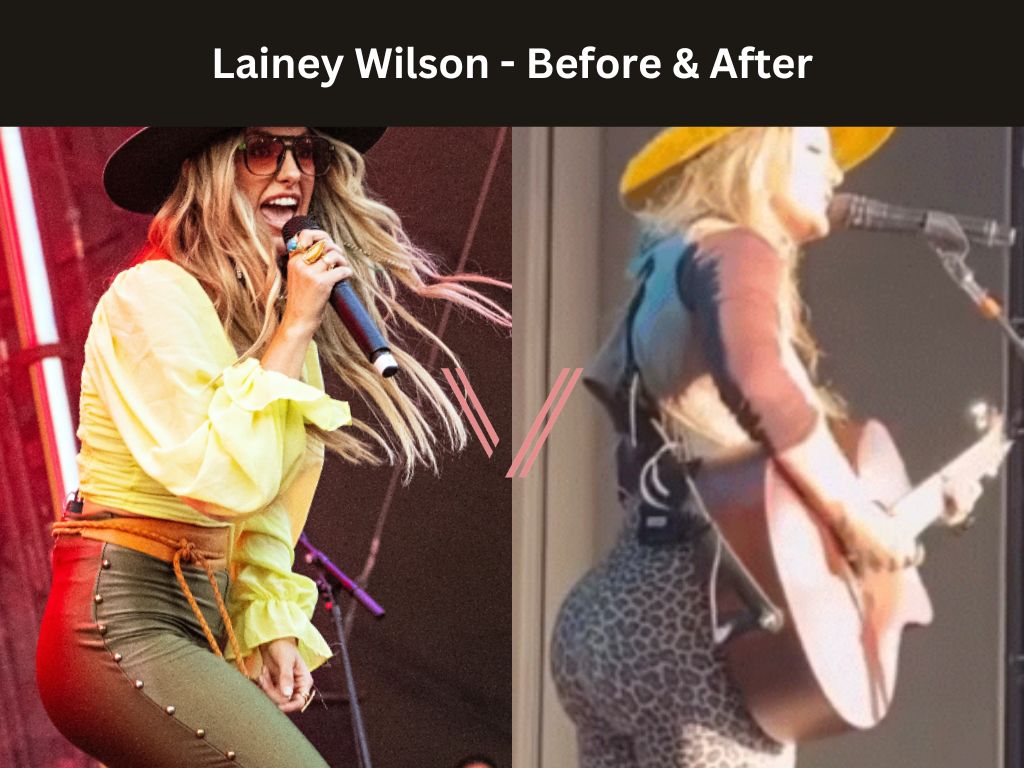 Lainey Wilson BBL Before and After