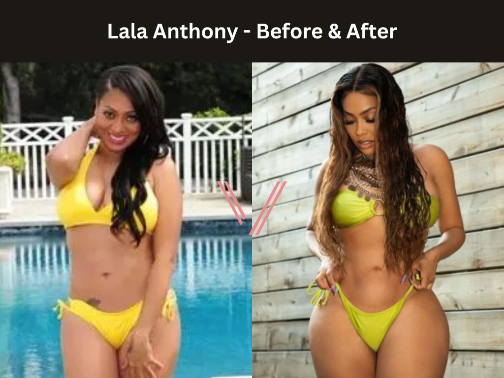 Lala Anthony BBL Before and After