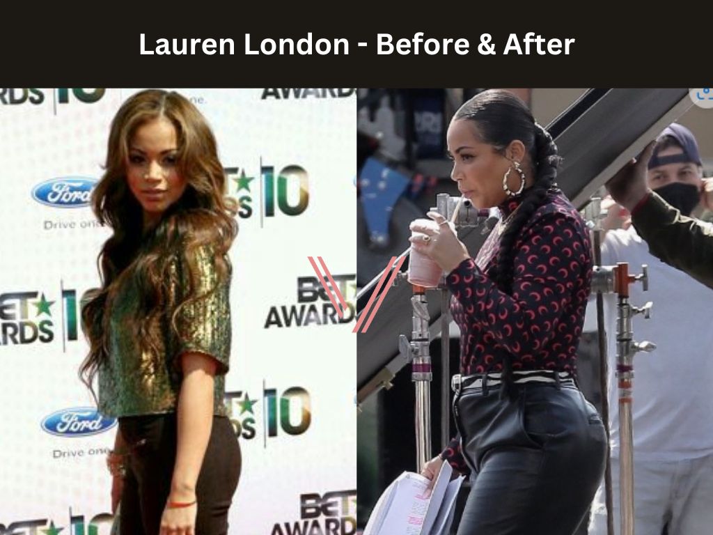 Lauren London BBL Before and After