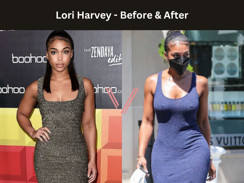 Lori Harvey BBL Before and After