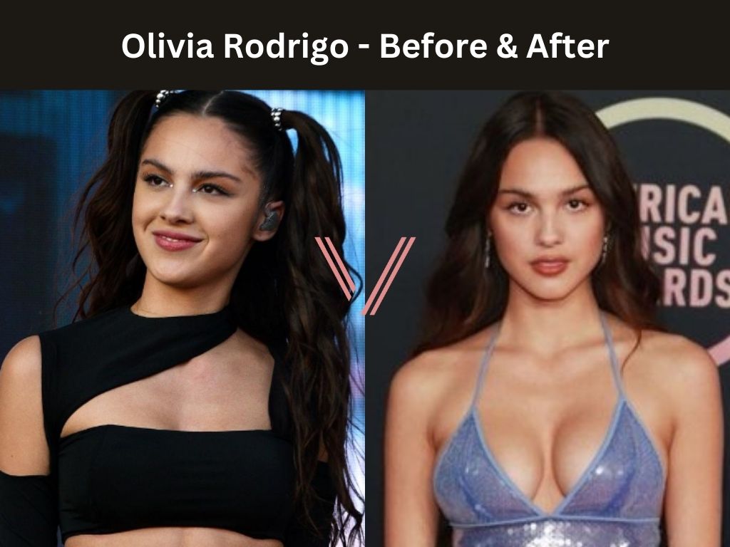 Olivia Rodrigo - Breast Implant Before and After
