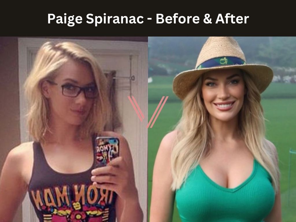 Paige Spiranac- Breast Implant Before and After
