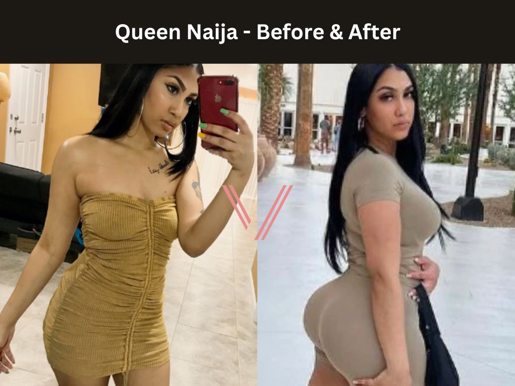 Queen Naija BBL Before and After