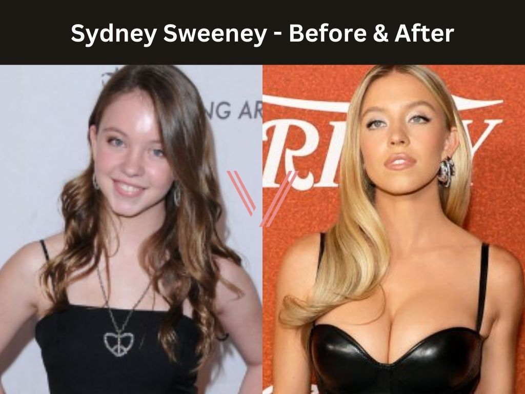 Sydney Sweeney Breast Implant Before and After