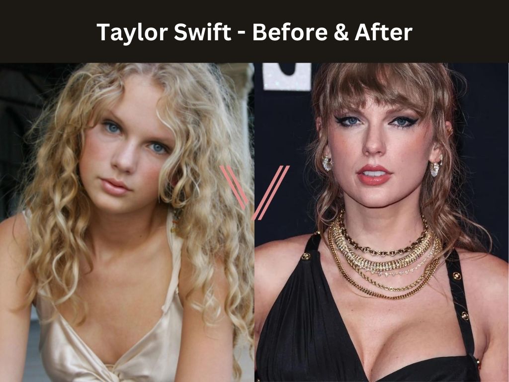 Taylor Swift - Breast Implant Before and After