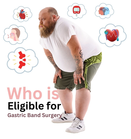Who is Eligible for Gastric Band Surgery