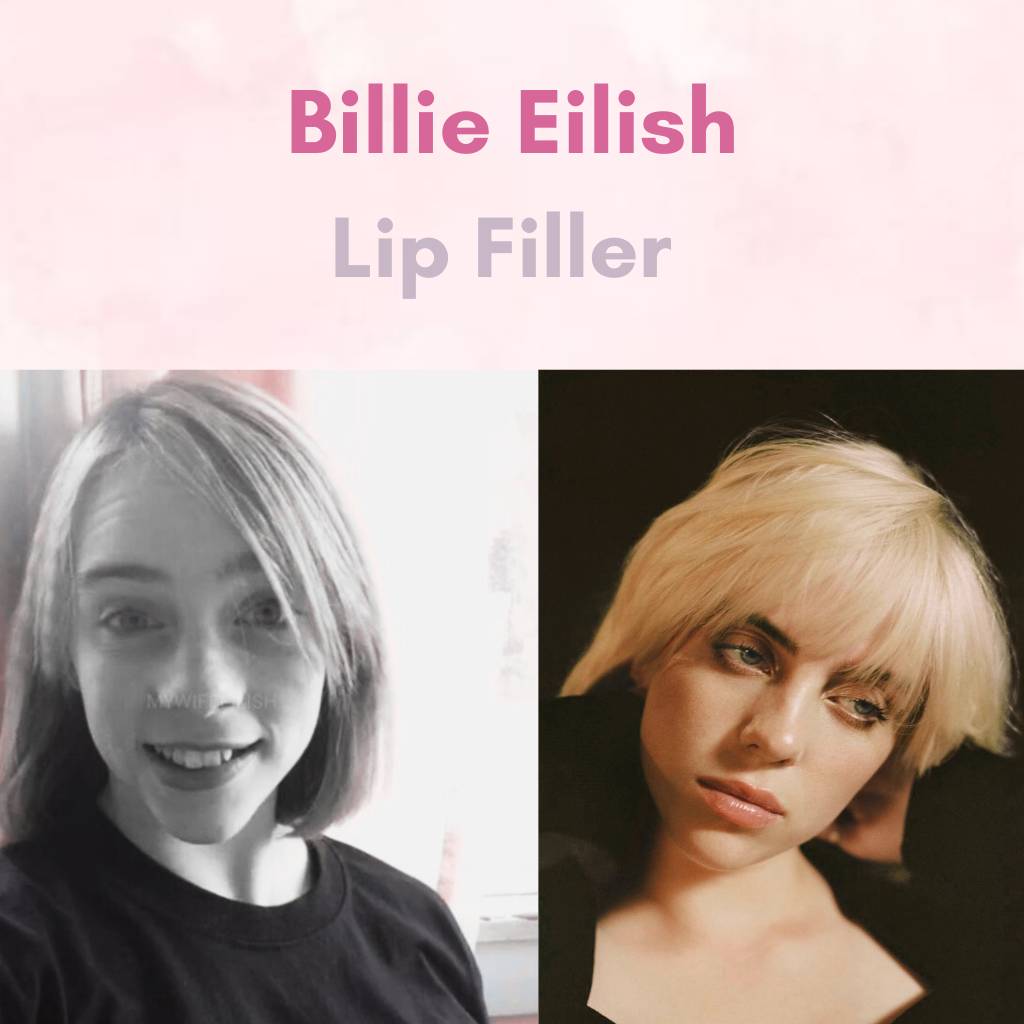 Billie Eilish before fame