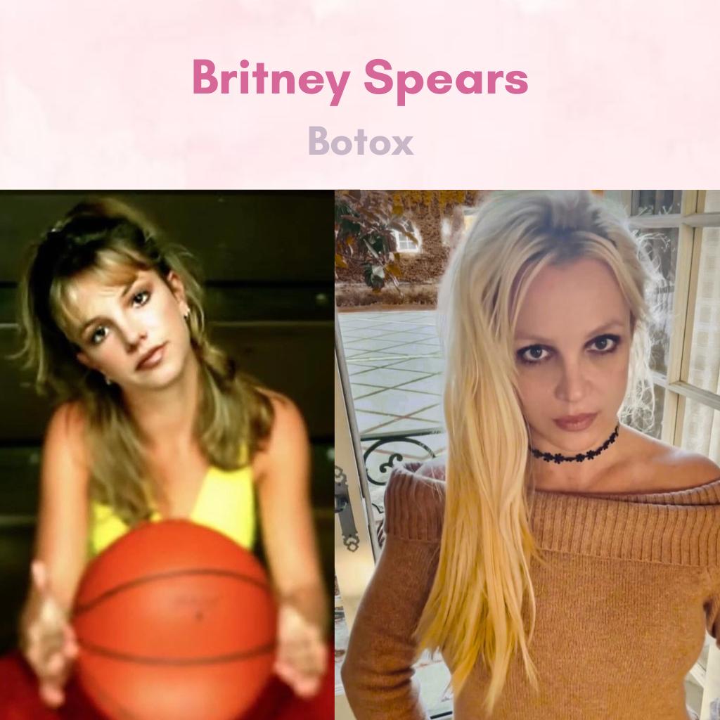 Britnery Spears with Botox