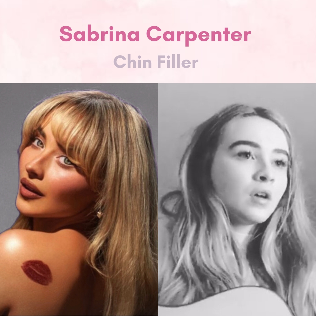 Sabrina Carpenter Chin Filler