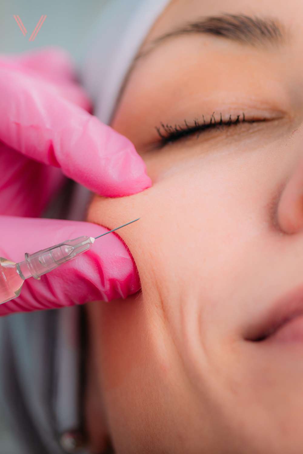 dermal injection for cheek
