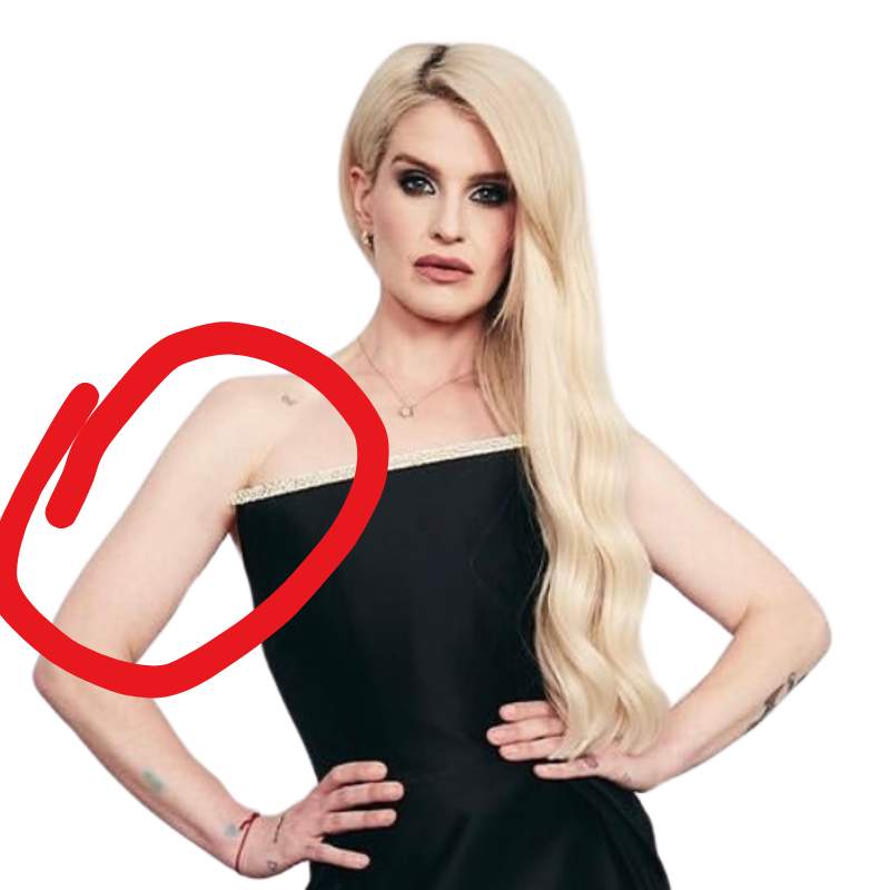 Kelly Osbourne arm lift surgery
