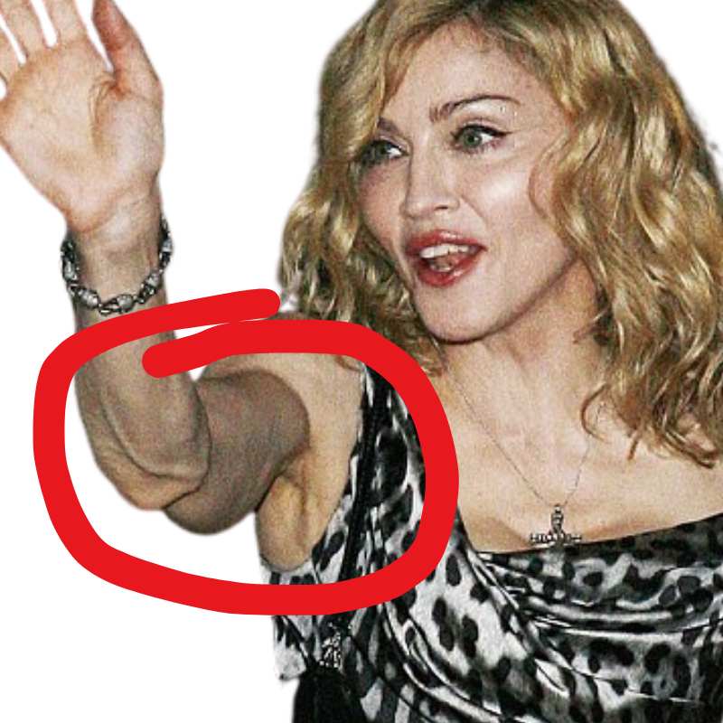 madonna saggy arm look