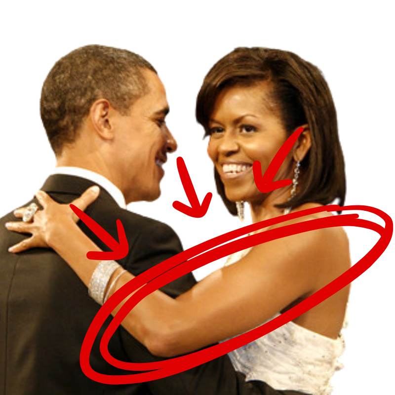 michelle obama arm surgery