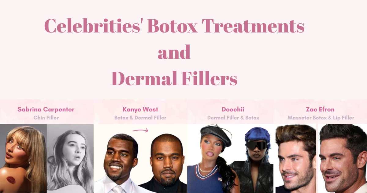 Botox American Singer 30 Celebrity Botox & Filler Favorites - Vantage Clinic